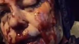 شاهد عینی از ساچمه‌زنی به صورت: «۲۵۰ ساچمه به چشم و صورتم خورد. کسی که به من شلیک کرد، تروریست بود. می‌خواست مرا بکشد.»