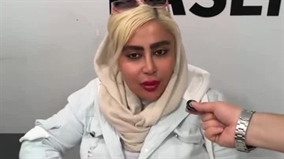 رضایتمندی زیباجو از انجام بلفاروپلاستی در کلینیک زیبایی آفرینش
