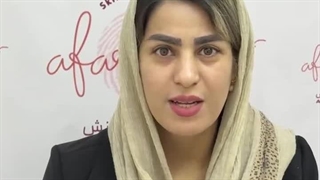 رضایتمندی زیباجو از کاشت ابرو در کلینیک آفرینش