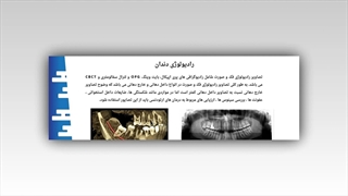 رادیولوژی دندان ؛ انواع تجهیزات تصویربرداری و کاربردهای تشخیصی : دکتر نکیسا ایل