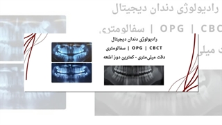 رادیولوژی دندان سعادت آباد ؛ مراکز تخصصی تصویربرداری و خدمات دیجیتال : مطب دکتر نکیسا ایل