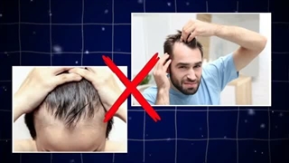 اگه موهات می‌ریزه، احتمالاً داری این 5 عادت اشتباه رو انجام میدی!