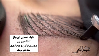 میکرو ابرو کلینیک زیبایی کیانا علیمردانی