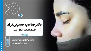 فرم اصلی بینی بعد از عمل دکتر صاحب حسینی نژاد در اهواز- پزشک 24