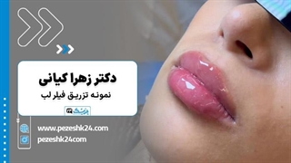 فیلم تزریق ژل لب در مطب دکتر زهرا کیانی در اصفهان- پزشک 24