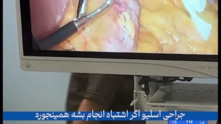 بازگشت وزن بعد از اسلیو چرا اتفاق می‌افتد؟