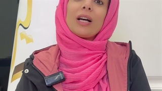 کاشت تخصصی ابرو در کلینیک سینا ( رنسانس )