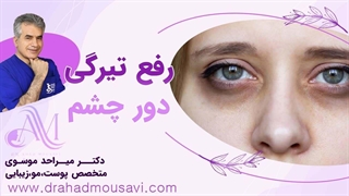 از سیاهی دور چشمت خلاص شو