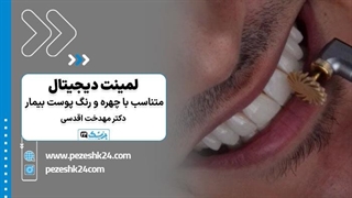 نمونه کارهای لمینت دندان؛ لمینت دندان چگونه انجام می‌شود؟ -پزشک24
