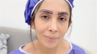کاشت ابرو به روش سوپر نچرال