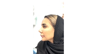 پایان قائم شدن پشت فیلتر های اینستاگرام