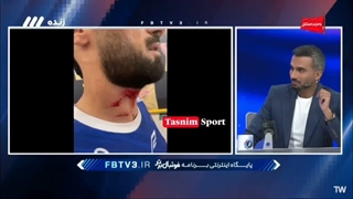 محسن خلیلی: جراحت عارف آقاسی صحنه قشنگیه!