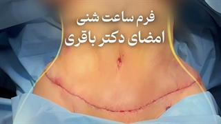 آیا افتادگی پوست با ورزش و رژیم درمان می‌شود؟