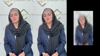 رضایت زیباجوی عزیز از کاشت ابرو در کلینیک سینا