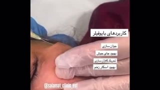 کاربردهای دستگاه پزشکی BIO Filler Maker