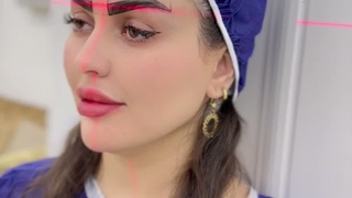کاشت ابرو میکرو sut در کلینیک سینا همان رنسانس معروف